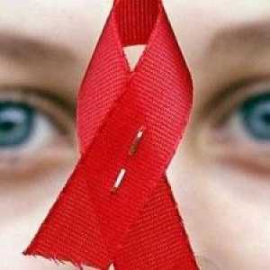 Objawy HIV