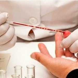 Skłonność do choroby altsgymera określić badanie krwi