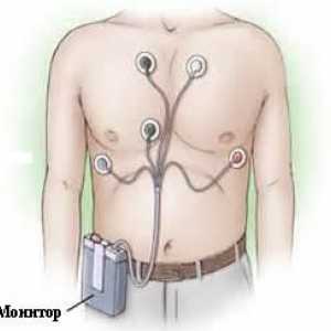 Codziennie (Holter) monitorowanie EKG i piekło