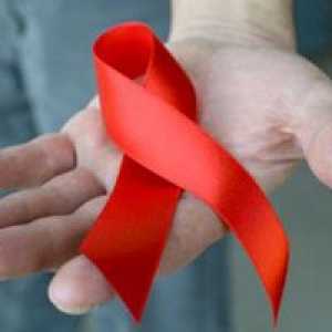 Zakażenie HIV i AIDS