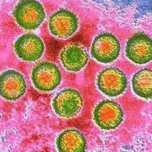 Wirus Epsteina-Barra (EBV lub infekcji zakażenie EBV)
