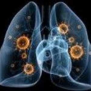 Wirus zapalenia płuc