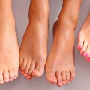 Swędzenie i zaczerwienienie skóry na nodze: pierwszy alarm